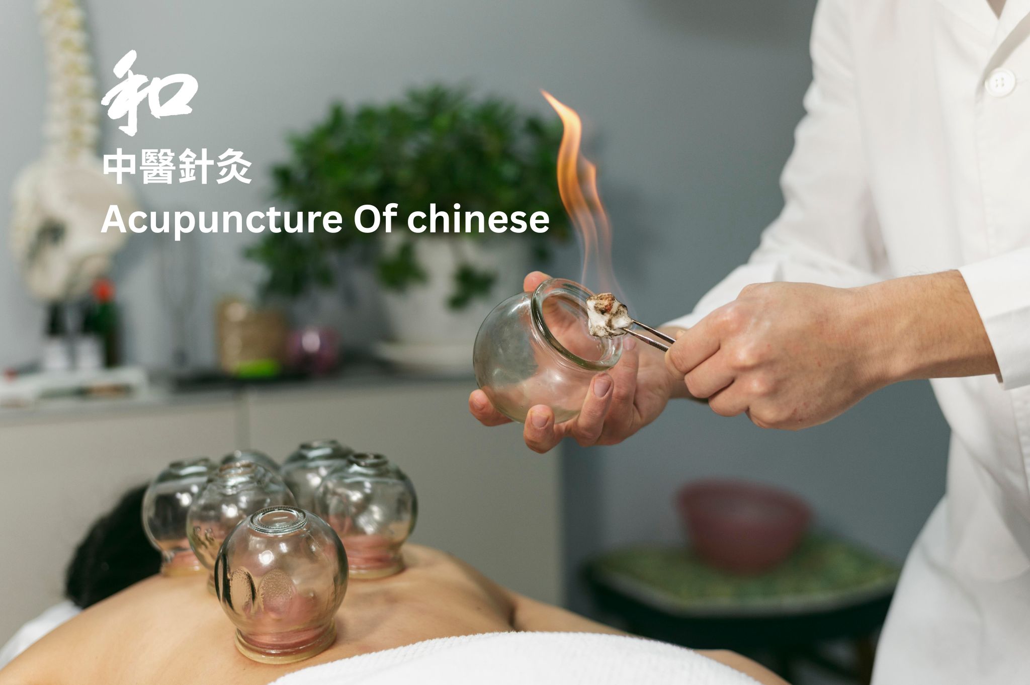 Acupuncture Work For Pain Relief In Matlock